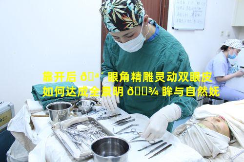 靠开后 🪴 眼角精雕灵动双眼皮如何达成全景明 🌾 眸与自然妩媚的效果